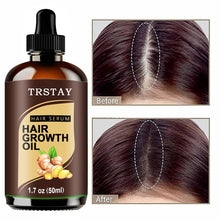 Load image into Gallery viewer, Powerful Hair Growth Oil Prevent Hair Loss
