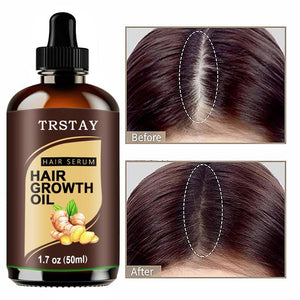 Powerful Hair Growth Oil Prevent Hair Loss