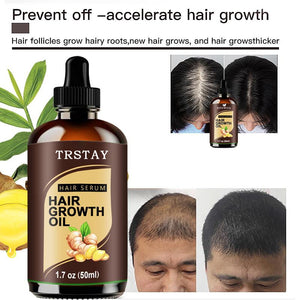 Powerful Hair Growth Oil Prevent Hair Loss